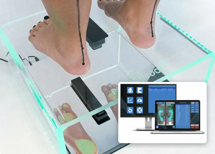 Piedi sul podoscopio per l'analisi dell'appoggio e, accanto, il programma con la scansione dei piedi